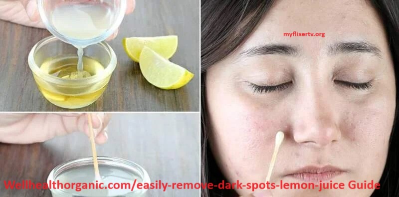 Wellhealthorganic Com Easily Remove Dark Spots Lemon Juice